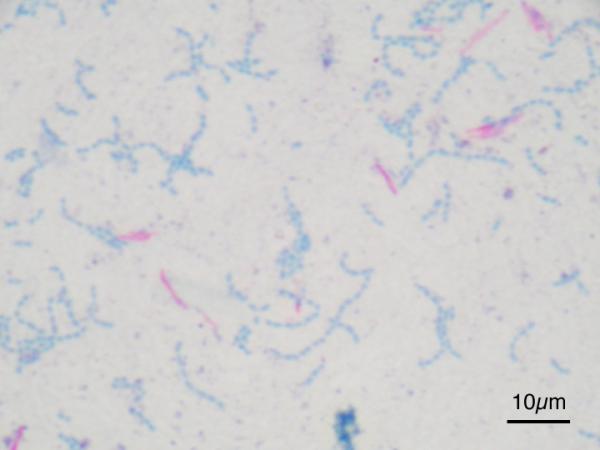 Naudan tuberkuloosi - Oireet ja diagnoosi - Mikä on naudan tuberkuloosi?