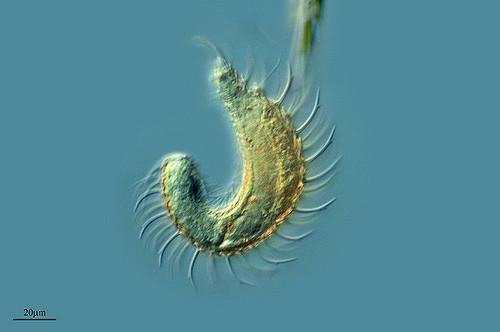 10 vähiten elävää eläintä - 1. Gastrotricos